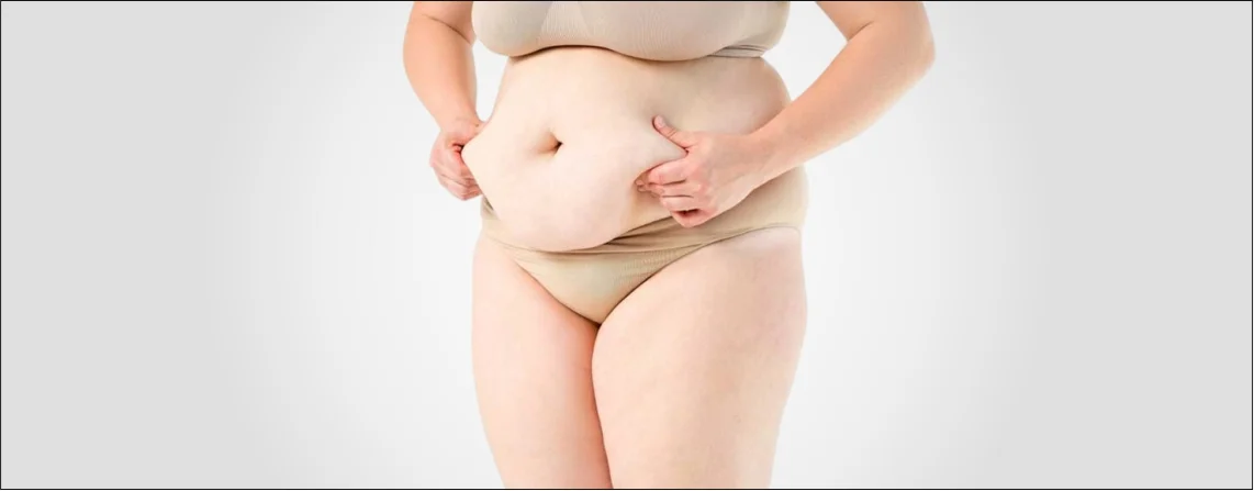 Tummy Tuck After Pregnancy