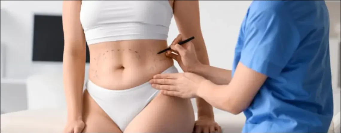 VASER Liposuction vs Traditional Liposuction